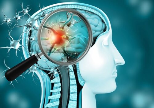 neurological diagnosis after COVID infection