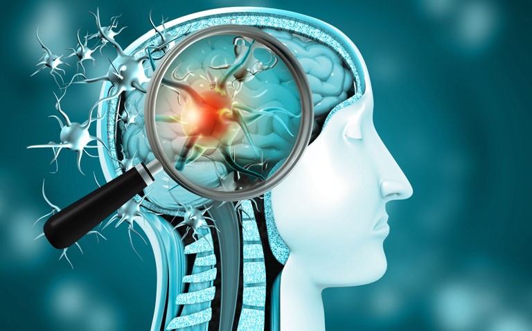 neurological diagnosis after COVID infection