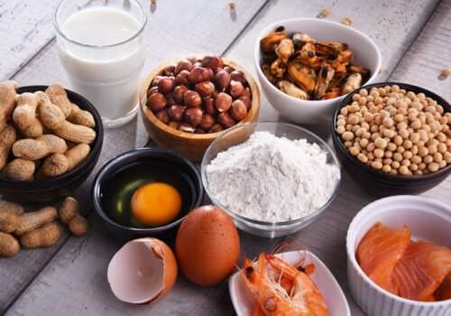 food allergies