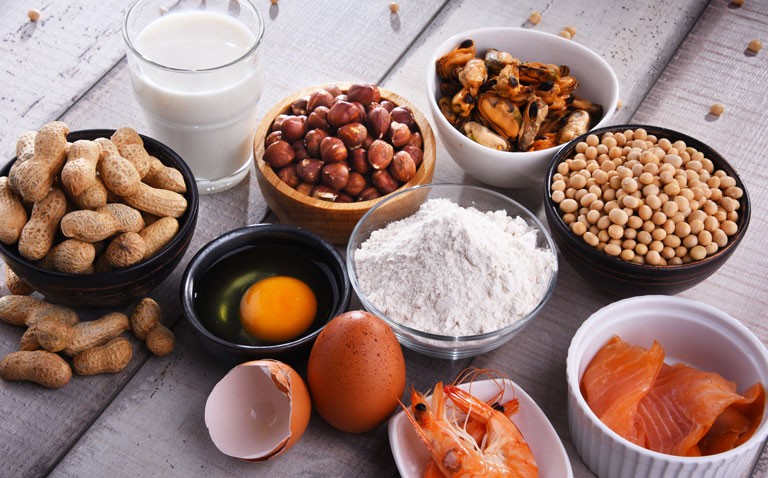 food allergies