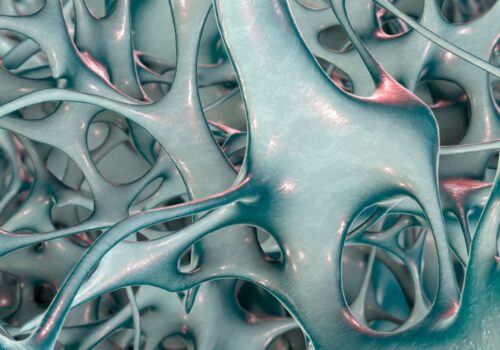 Slight increased risk of osteoporosis and fractures with long-term use of certain topical steroids