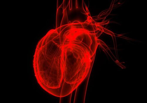 Is ischaemic heart disease induced by severe Covid-19?