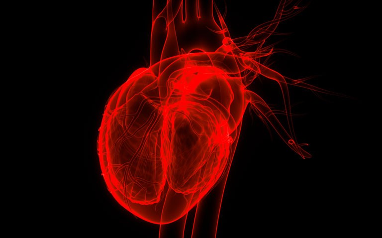 Is ischaemic heart disease induced by severe Covid-19?