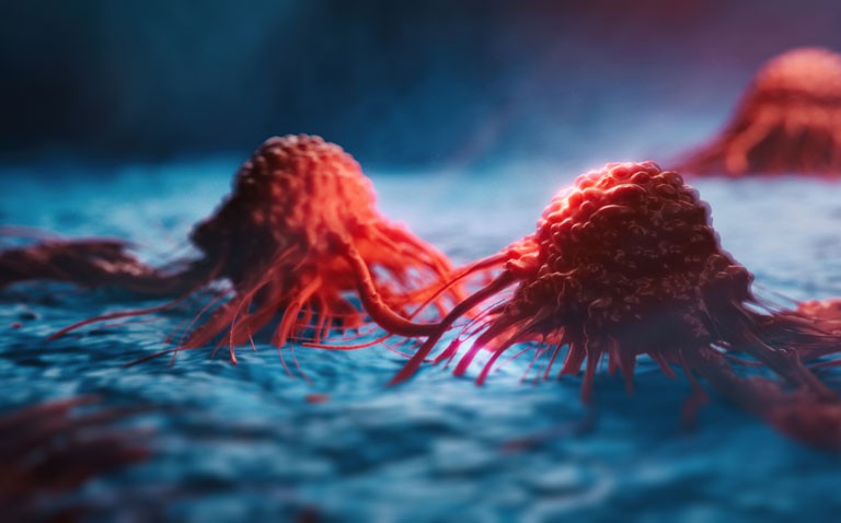 Thiazide diuretics and increased risk of skin cancer