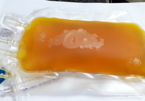 convalescent plasma