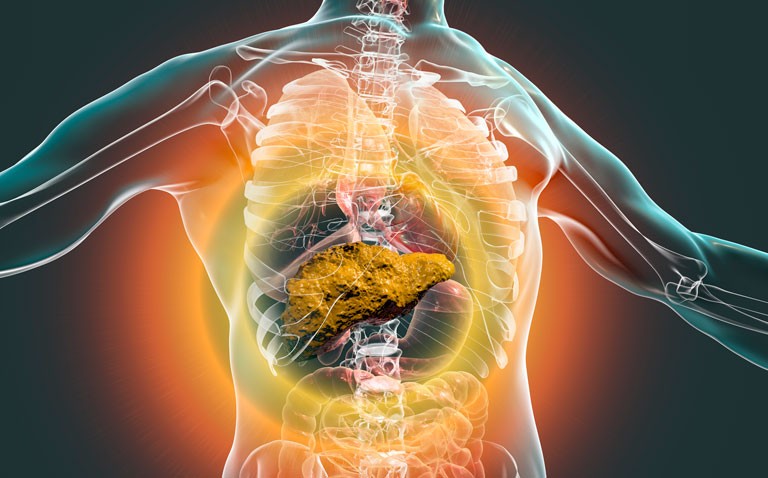 cirrhosis in covid