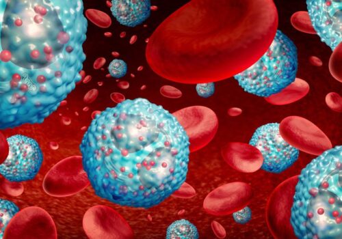 eosinophilic astham