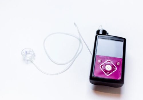 CGM associated with better control in type 2 diabetes alongside basal insulin