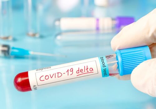 Higher risk of hospitalisation from delta Covid-19 variant