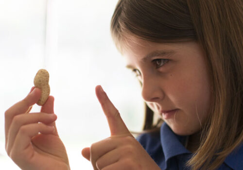 peanut allergy
