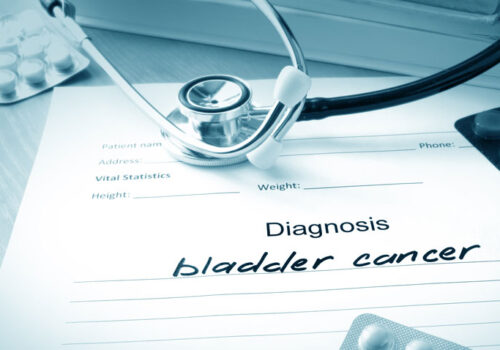 bladder cancer