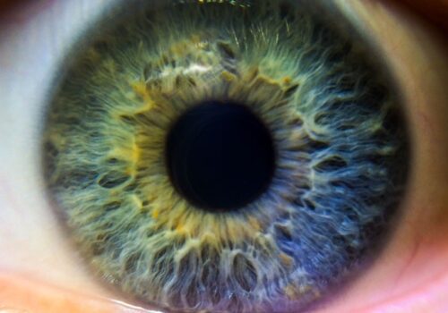 COVID and ocular symptoms