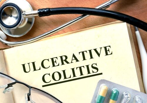 biomarkers ulcerative colitis