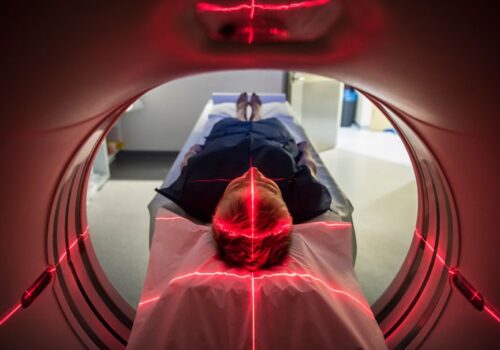 PET scan