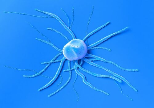 colorectal cancer and dietary factors