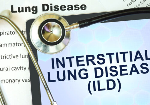 interstitial lung disease