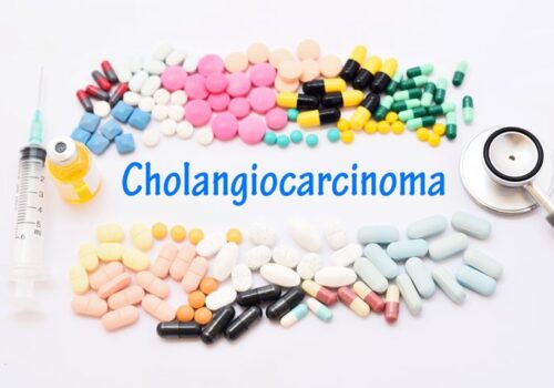 cholangiocarcinoma