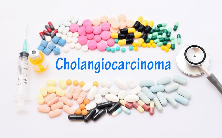 cholangiocarcinoma
