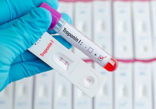 prognostic effect of troponin I in COVID