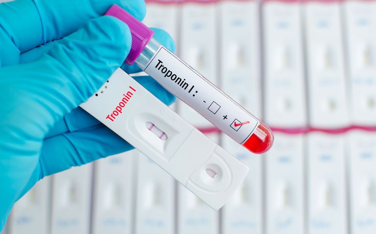 prognostic effect of troponin I in COVID