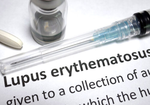 systemic lupus erythematosus