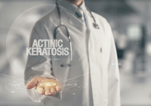 Increased risk of squamous cell cancer in those diagnosed with actinic keratoses