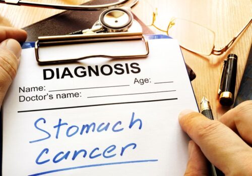 stomach cancer