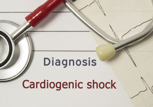 Milrinone and dobutamine equally effective in cardiogenic shock