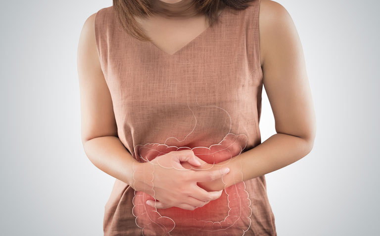 irritable bowel syndrome