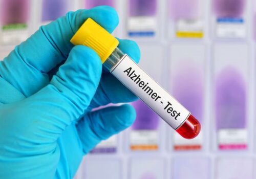 Alzheimer's disease