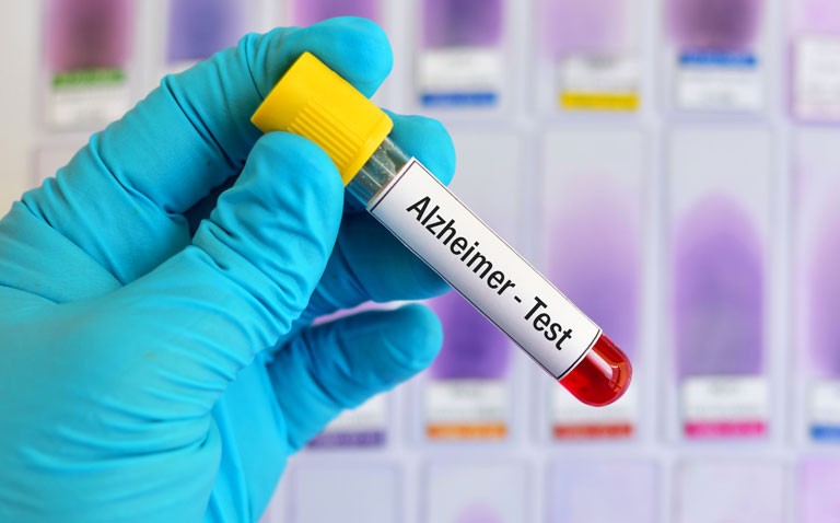 Alzheimer's disease