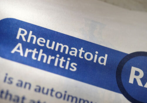 rheumatoid arthritis