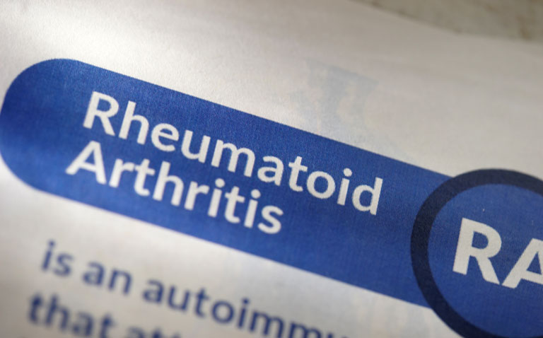 rheumatoid arthritis