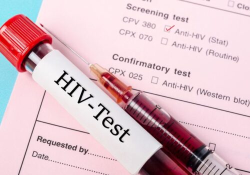 hiv screening