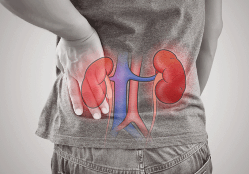 Higher mean arterial pressure unlikely to prevent AKI in shock and perioperative patients
