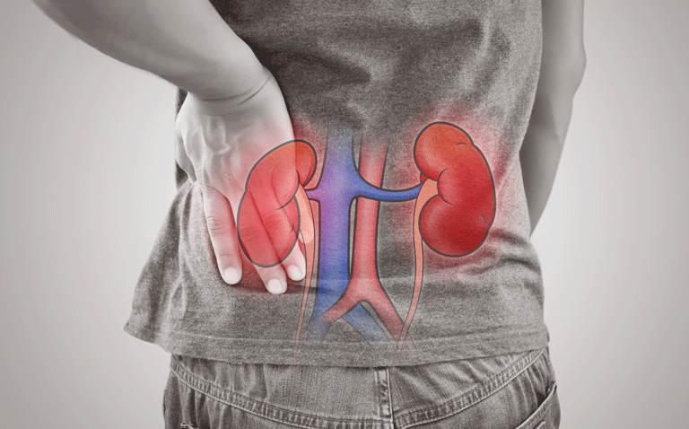 Higher mean arterial pressure unlikely to prevent AKI in shock and perioperative patients