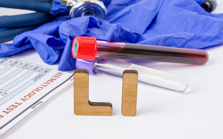 Higher risk of osteoporosis in bipolar disorder reduced by lithium therapy