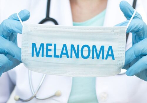Immune checkpoint inhibitors combined with radiotherapy offers no survival benefit in melanoma
