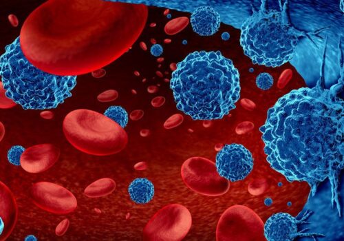 Improved clinical outcomes for haematological malignancy COVID-19 patients after convalescent plasma therapy