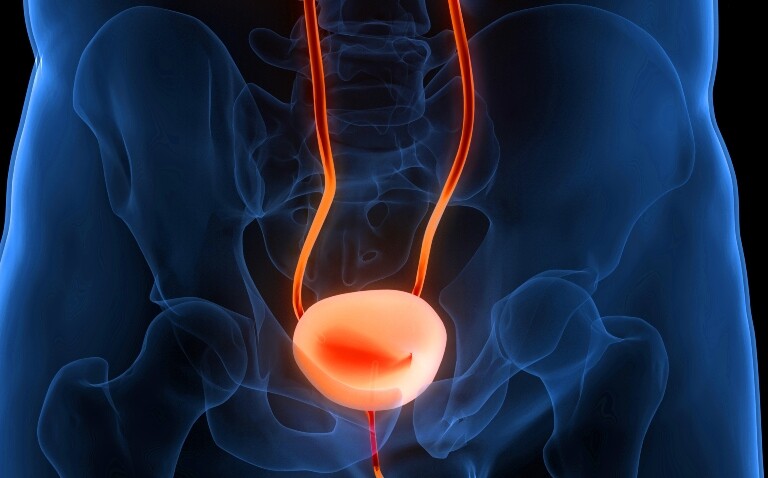 A computer generated image of a red bladder with a faded blue pelvis outline in the background to illustrate improving treatment pathways in muscle-invasive bladder cancer|A table outlining the staging conventions of non-muscle-invasive bladder cancer and muscle-invasive bladder cancer