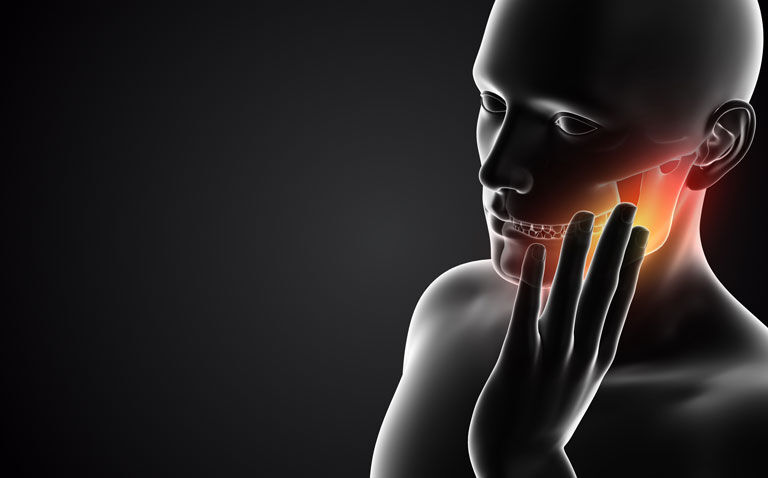 |RRx-001 infusion reduces oral mucositis following chemoradiotherapy
