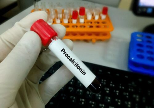 Can procalcitonin levels determine which patients will benefit from azithromycin in lower RI? |Low procalcitonin levels fail to identify lower RI patients who benefit from azithromycin|Low-procalcitonin-levels-fail-to-identify-lower-RI-patients-who-benefit-from-azithromycin