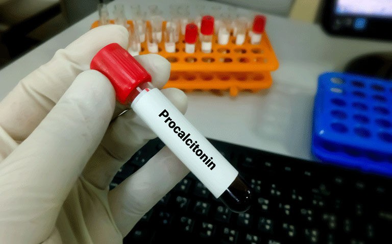 Can procalcitonin levels determine which patients will benefit from azithromycin in lower RI? |Low procalcitonin levels fail to identify lower RI patients who benefit from azithromycin|Low-procalcitonin-levels-fail-to-identify-lower-RI-patients-who-benefit-from-azithromycin