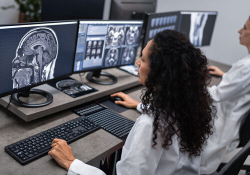 Nearly a third of radiographers unsure how AI reaches decisions