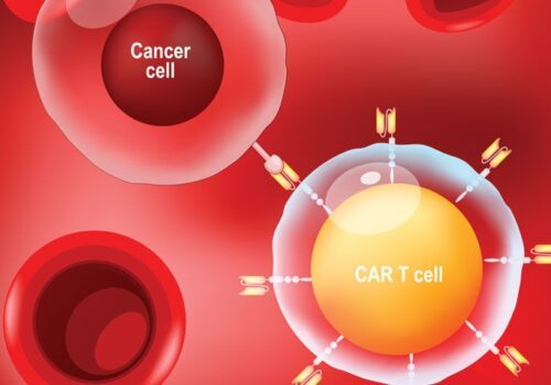Next day CAR T cells effective and safe in acute lymphoblastic leukaemia