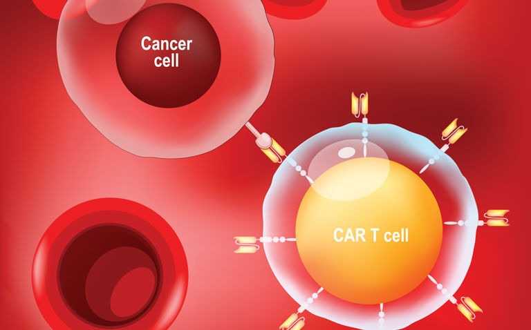 Next day CAR T cells effective and safe in acute lymphoblastic leukaemia