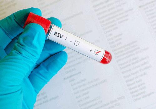 Nirsevimab approved by EMA for RSV in newborns and infants