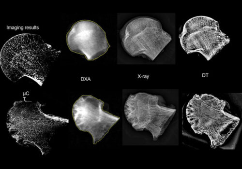 Novel compact DT imaging in inflammatory arthritis showing comparative imaging of ex-vivo human hips