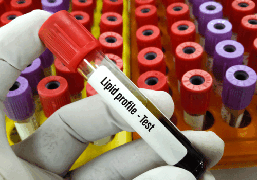 Olpasiran substantially reduces lipoprotein A levels in cardiovascular disease patients