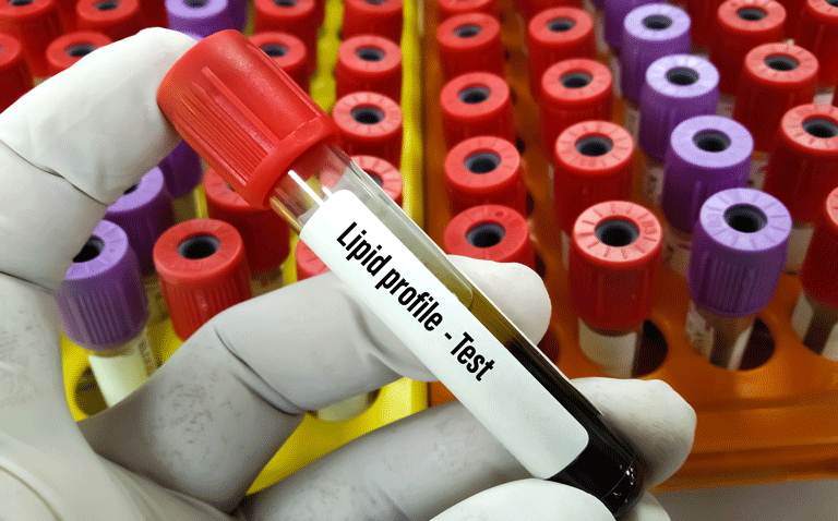 Olpasiran substantially reduces lipoprotein A levels in cardiovascular disease patients